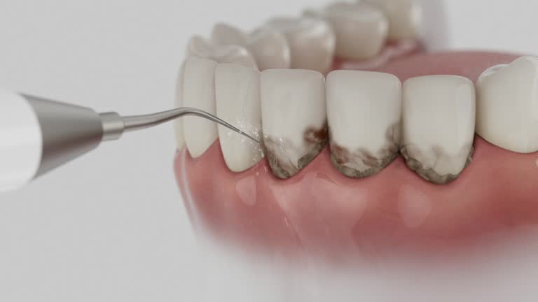 Reliable Emergency Dentist contractor in Akron, CO by Smile Center Dentistry